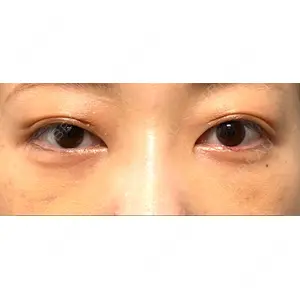 APOLLO BEAUTY CLINIC口コミ