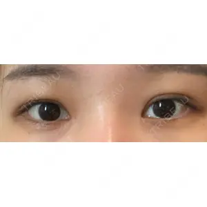 APOLLO BEAUTY CLINIC口コミ