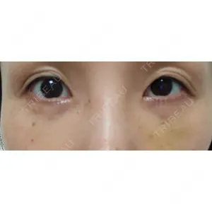 APOLLO BEAUTY CLINIC口コミ