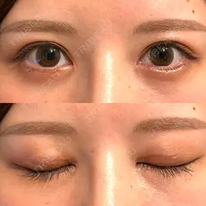 いちのせ形成外科・皮膚科 眼瞼＆フェイスクリニック口コミ