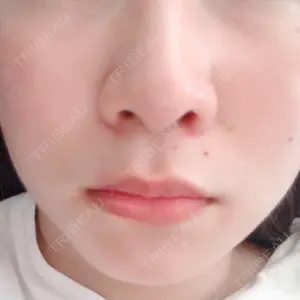 口コミ