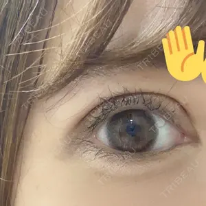 東京BELLEZZAクリニック口コミ