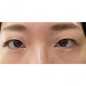APOLLO BEAUTY CLINIC口コミ