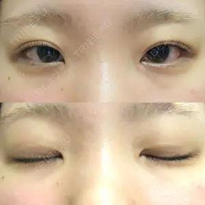 R.O.clinic口コミ