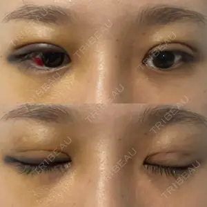 TCB東京中央美容外科 TCB東京中央美容外科 新宿三丁目院口コミ