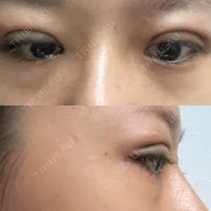 TCB東京中央美容外科 TCB東京中央美容外科 新宿三丁目院口コミ