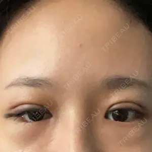 TCB東京中央美容外科 TCB東京中央美容外科 新宿三丁目院口コミ