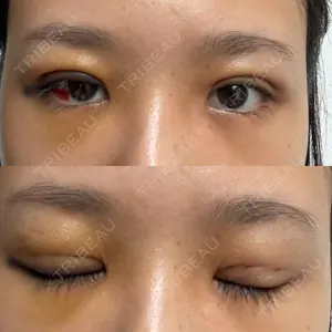 TCB東京中央美容外科 TCB東京中央美容外科 新宿三丁目院口コミ