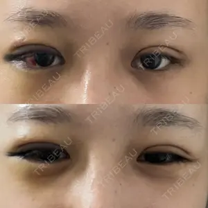 TCB東京中央美容外科 TCB東京中央美容外科 新宿三丁目院口コミ