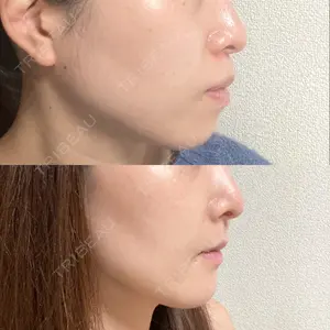 口コミ