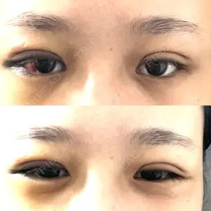 TCB東京中央美容外科 TCB東京中央美容外科 新宿三丁目院口コミ
