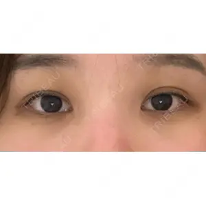 APOLLO BEAUTY CLINIC口コミ