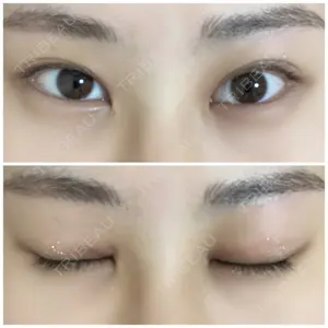 聖心美容クリニック グループ 聖心美容クリニック 六本木院口コミ