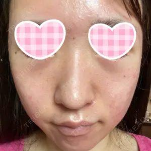UB CLINIC銀座口コミ