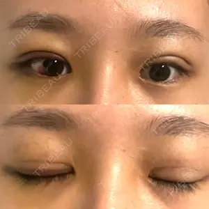 TCB東京中央美容外科 TCB東京中央美容外科 新宿三丁目院口コミ