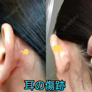 口コミ