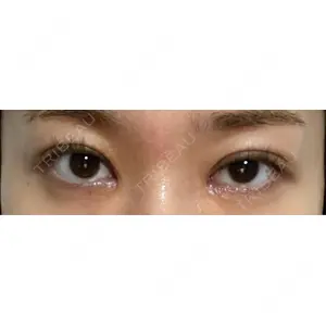 いちのせ形成外科・皮膚科 眼瞼＆フェイスクリニック口コミ