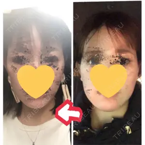 聖心美容クリニック グループ 聖心美容クリニック 六本木院口コミ