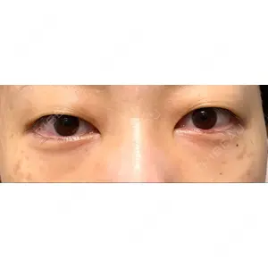 APOLLO BEAUTY CLINIC口コミ
