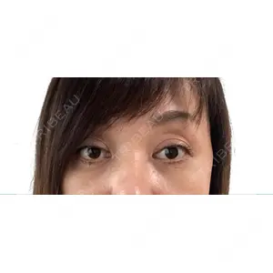 APOLLO BEAUTY CLINIC口コミ