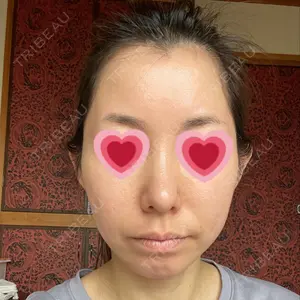 TCB東京中央美容外科 TCB東京中央美容外科 中野院口コミ