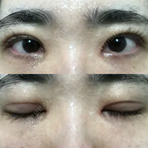 東京イセアクリニック口コミ