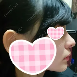 HANABI整形外科口コミ