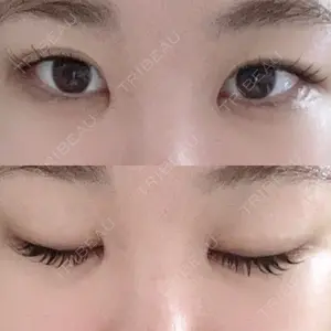 目白ポセンシアクリニック口コミ