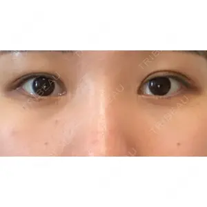 APOLLO BEAUTY CLINIC口コミ