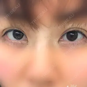 みやび形成外科口コミ