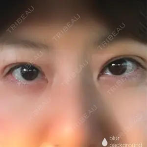 みやび形成外科口コミ