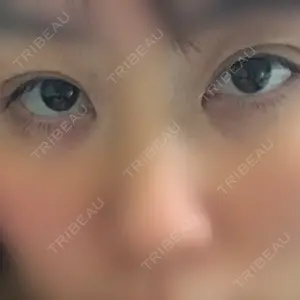 みやび形成外科口コミ