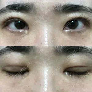 東京イセアクリニック口コミ