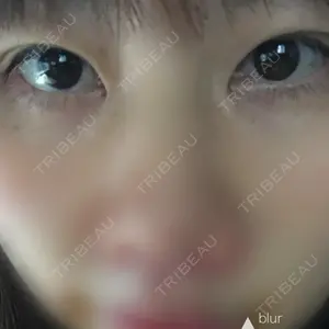 みやび形成外科口コミ