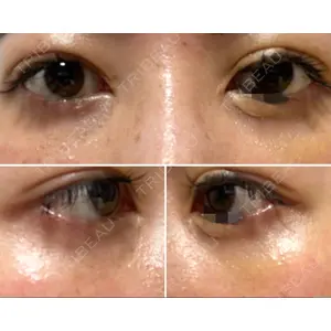 APOLLO BEAUTY CLINIC口コミ