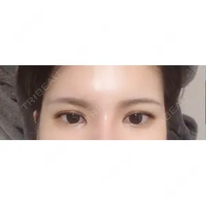 東京BELLEZZAクリニック口コミ