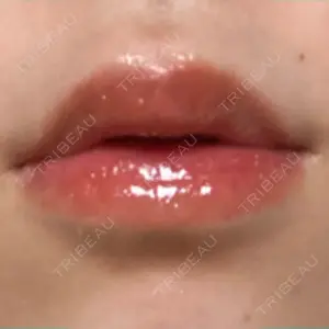 B-LINE CLINIC B-LINE CLINIC 池袋院口コミ