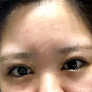 湘南美容クリニック 湘南美容クリニック 池袋東口院口コミ