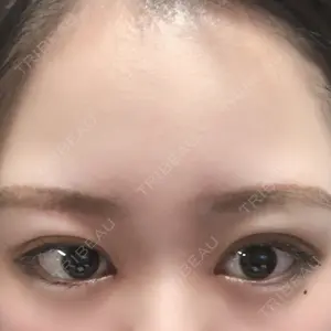 湘南美容クリニック 湘南美容クリニック 池袋東口院口コミ