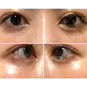 APOLLO BEAUTY CLINIC口コミ