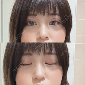 TCB東京中央美容外科 上野院の