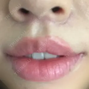 東京皮膚科・形成外科 東京皮膚科・形成外科 (銀座いけだクリニック)口コミ