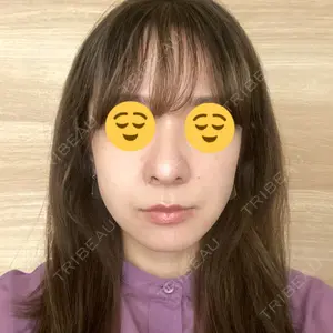 TCB東京中央美容外科 TCB東京中央美容外科 新宿三丁目院口コミ