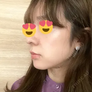 TCB東京中央美容外科 TCB東京中央美容外科 新宿三丁目院口コミ