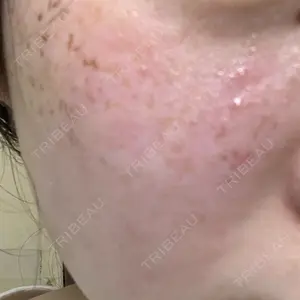 南青山TOKUNAKAクリニック口コミ