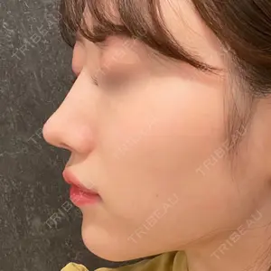 Zetith Beauty Clinic Zetith Beauty Clinic 銀座院口コミ