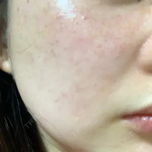 南青山TOKUNAKAクリニック口コミ