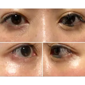 APOLLO BEAUTY CLINIC口コミ