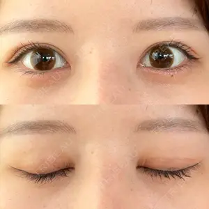 いちのせ形成外科・皮膚科 眼瞼＆フェイスクリニック口コミ