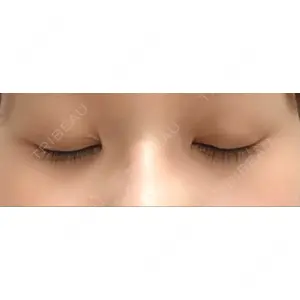 APOLLO BEAUTY CLINIC口コミ